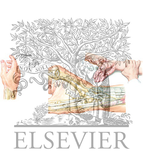 De Quervain Tenosynovitis