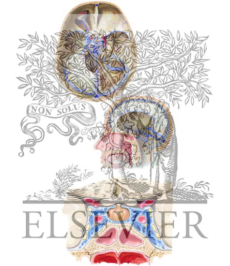 Watermarked preview of unlabeled image: Dural Venous Sinuses