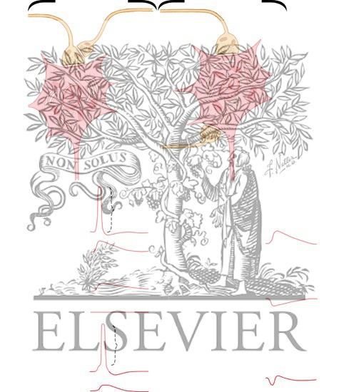 Watermarked preview of unlabeled image: Presynaptic and Postsynaptic Inhibition