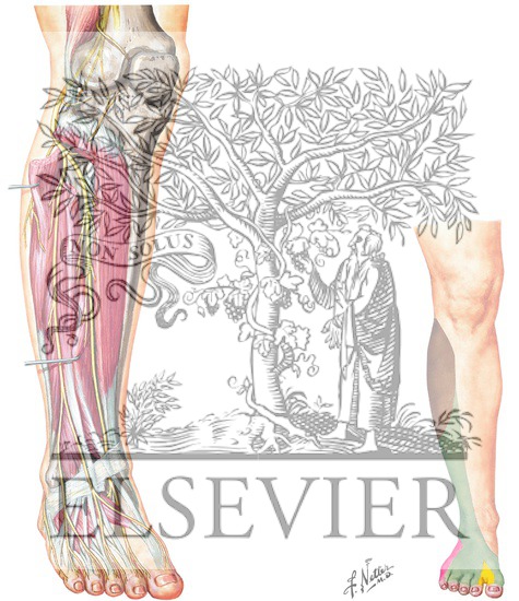 Watermarked preview of unlabeled image: Common Peroneal Nerve