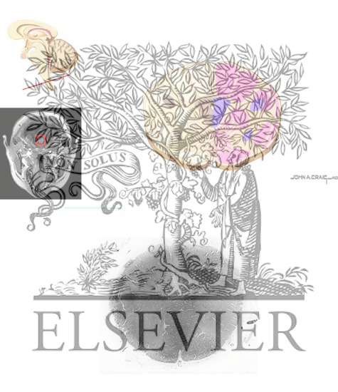 Watermarked preview of unlabeled image: Brain Stem Cross-Sectional Anatomy: Section 1