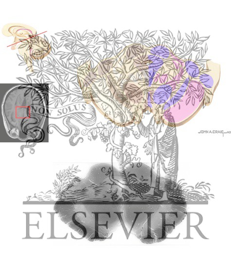 Watermarked preview of unlabeled image: Brain Stem Cross-Sectional Anatomy: Section 13