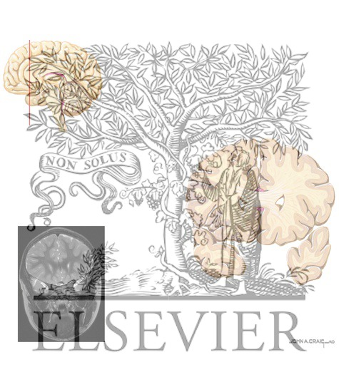 Watermarked preview of unlabeled image: A. Coronal Sections Through the Forebrain: Level 1 - Genu of Corpus Callosum