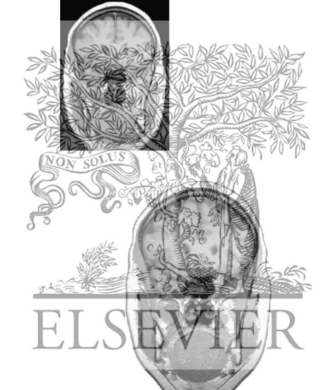 Watermarked preview of unlabeled image: B. Coronal Sections Through the Forebrain: Level 1 - Genu of Corpus Callosum (Continued)