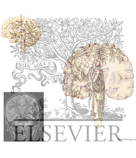 Watermarked preview of unlabeled image: A. Coronal Sections Through the Forebrain: Level 6 - Mammillothalamic Tract and Substantia Nigra, Rostral Hippocampus