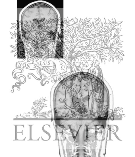 Watermarked preview of unlabeled image: B. Coronal Sections Through the Forebrain: Level 9 - Caudal Pulvinar and Superior Colliculus (Continued)