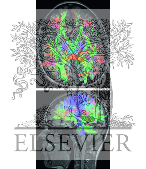 Watermarked preview of unlabeled image: Color Imaging of Association ...