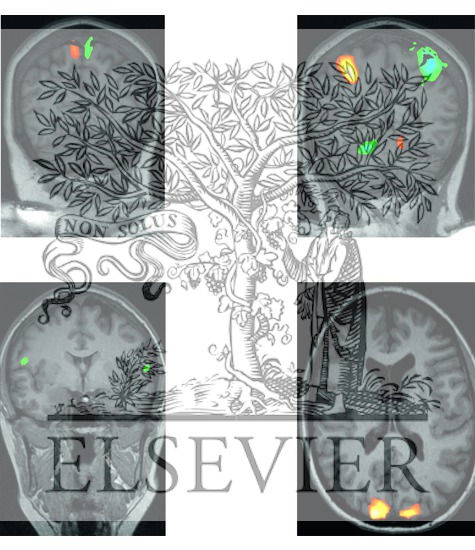Watermarked preview of unlabeled image: Functional Magnetic Resonance Imaging