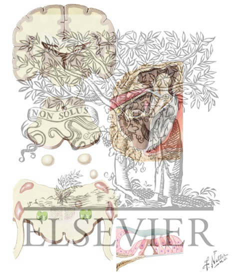 Watermarked preview of unlabeled image: Centrifugal (Efferent) Auditory Pathways
