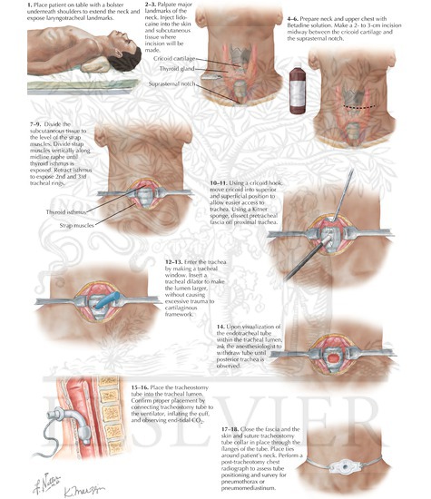 Welcome To Netter Images