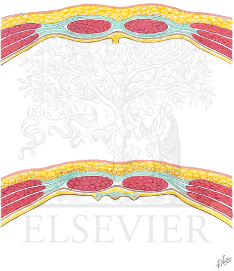 Watermarked preview of unlabeled image: Rectus sheath: cross section