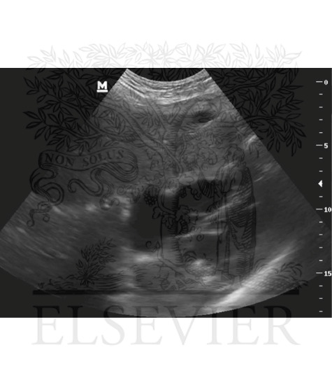 Watermarked preview of unlabeled image: Left upper quadrant view