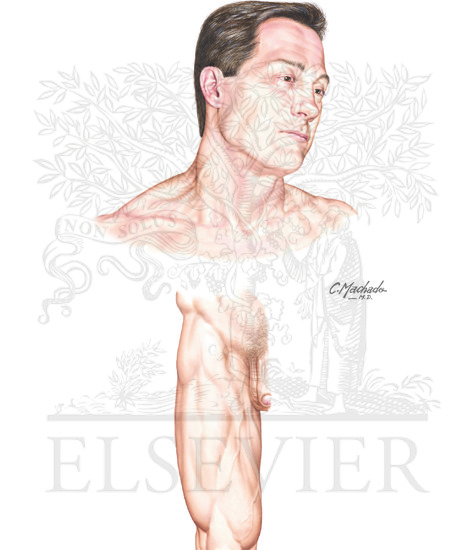 Watermarked preview of unlabeled image: Insertion sites for internal jugular vein and femoral vein catheterization