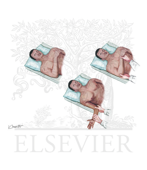 Dislocated Shoulder Joint Reduction : Lateral Rotation Maneuver