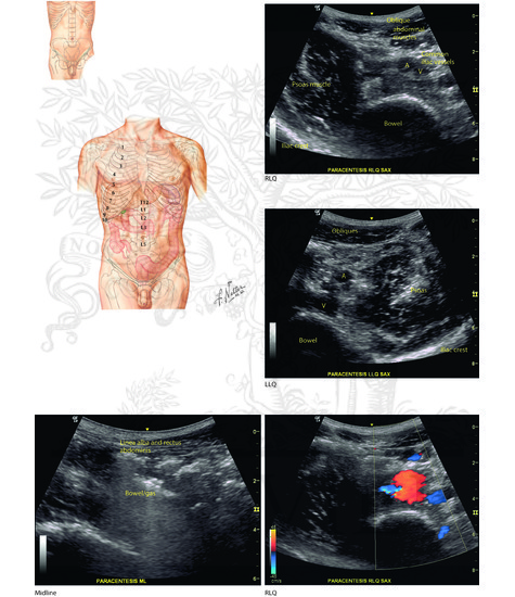 Regions and planes of the abdomen