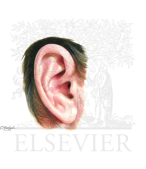 Right auricle (pinna)