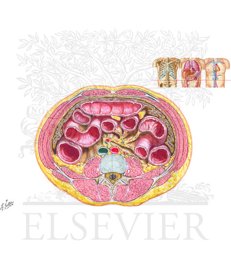 Watermarked preview of unlabeled image: Cross Section at L3, 4