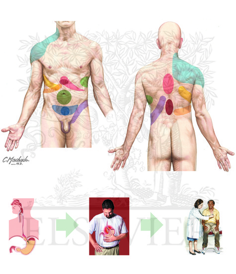 Watermarked preview of unlabeled image: Visceral Referred Pain 