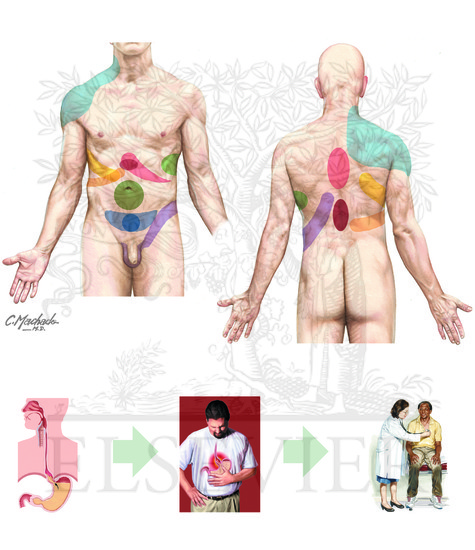 Visceral Referred Pain 