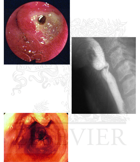 Overview Imaging the Upper Gastrointestinal Tract