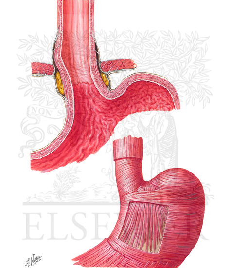 Esophagogastric Junction