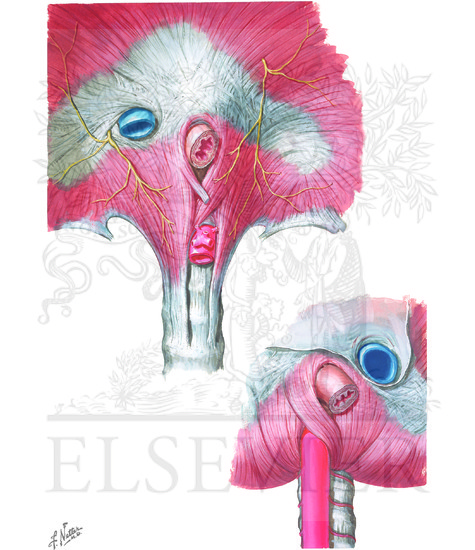 Esophagogastric Junction (Continued): Diaphragmatic Crura and Orifices