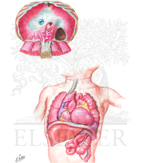 Watermarked preview of unlabeled image: Congenital Diaphragmatic Hernia