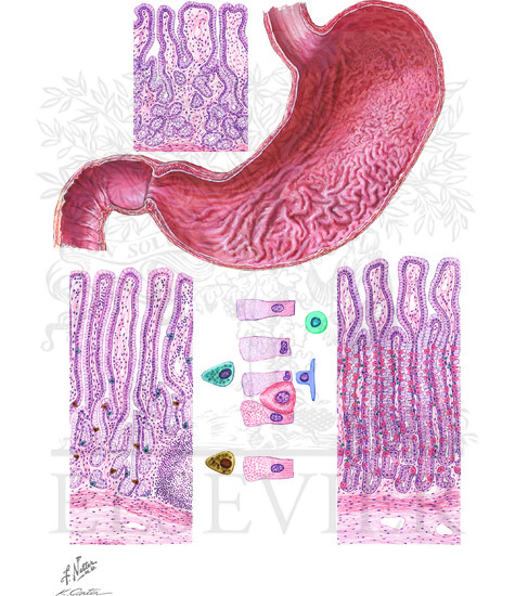 Watermarked preview of unlabeled image: Mucous Membrane of Stomach