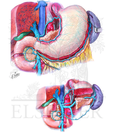 Watermarked preview of unlabeled image: Venous Drainage of Stomach and Duodenum