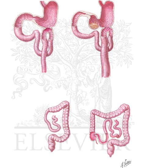 Watermarked preview of unlabeled image: Physiology of Gastroenteric Stomas