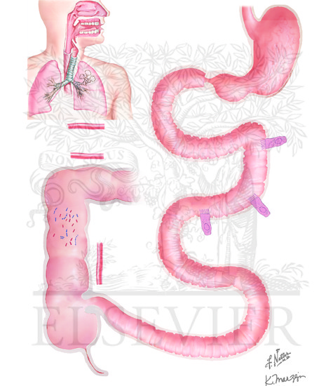 Watermarked preview of unlabeled image: Carbohydrate Malabsorption, Including Lactose Malabsorption