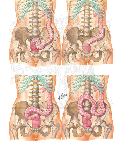 Watermarked preview of unlabeled image: Topography and Relations of Colon (Continued): Typical Sigmoid Colon and Variations