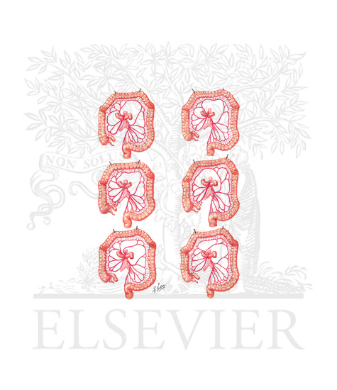 Watermarked preview of unlabeled image: Blood Supply of the Large Intestine (Continued): Variations In Colic Arteries