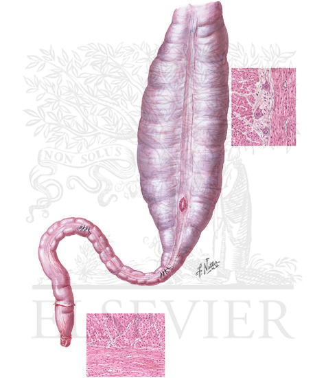 Watermarked preview of unlabeled image: Congenital Intestinal Obstruction: Hirschsprung's Disease (Continued): AGANGLIONIC MEGACOLON