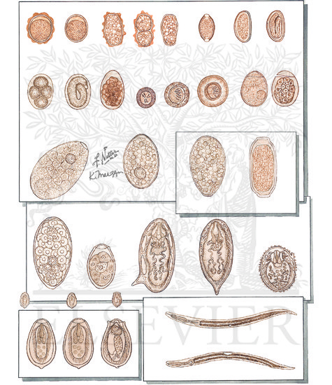 Helminths and Protozoa Infesting the Human Intestine: Ova of Helminth Parasites and Pseudoparasites and Rhabditiform Larvae