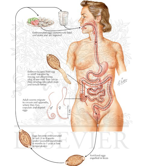 Parasitic Diseases: Trichuriasis