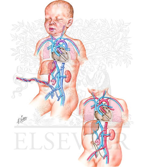 Watermarked preview of unlabeled image: Prenatal and Postnatal Circulation