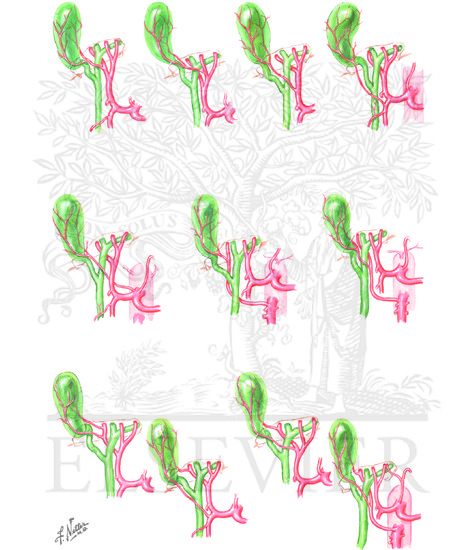 Watermarked preview of unlabeled image: Cyctic Artery and Its Variations