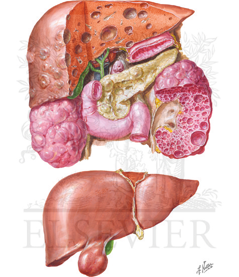 Congenital Anomalies