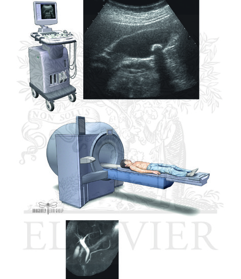 Noninvasive Imaging of the Gallbladder and Bile Ducts