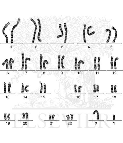 Normal male karyotype