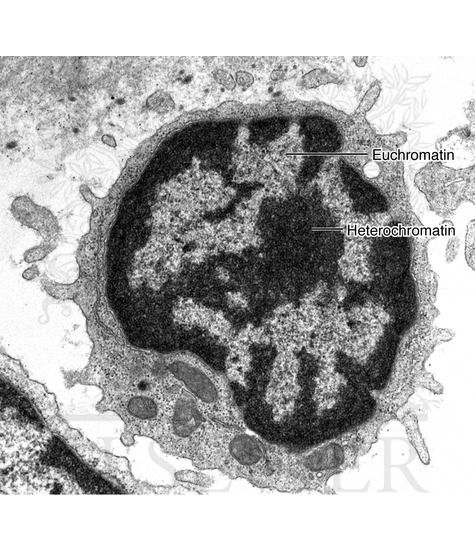 Euchromatin and heterochromatin in the nucleus of a lymphocyte as seen by transmission electron microscopy