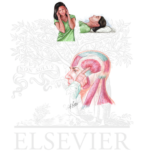 Watermarked preview of unlabeled image: Muscle Contraction Headache