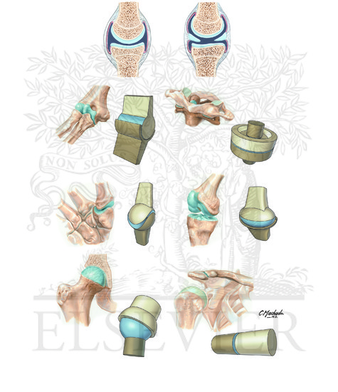 Types of Synovial Joints 