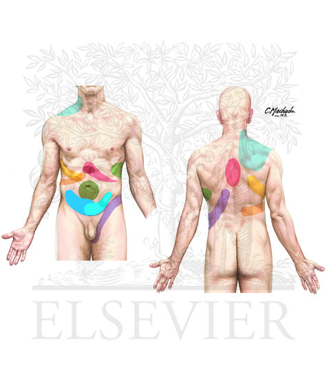 Sites of Visceral Referred Pain 