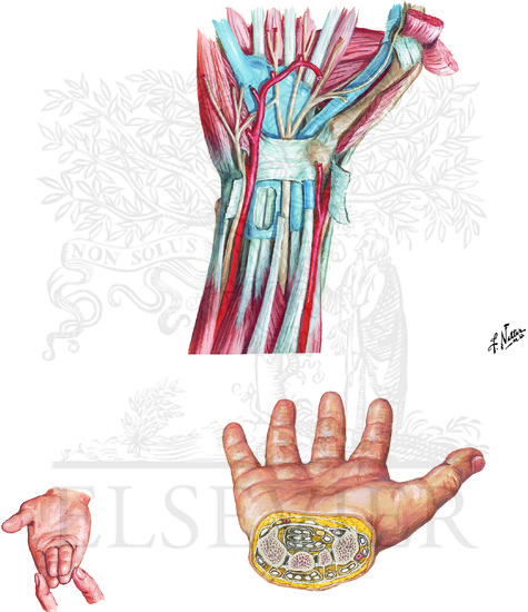 Flexor Tendons, Arteries, and Nerves at Wrist