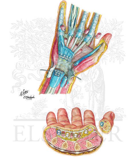 Spaces, Bursae, and Tendon and Lumbrical Sheaths of Hand