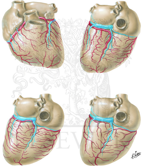 Coronary Arteries And Cardiac Veins Variations