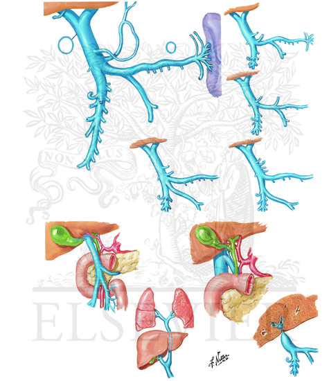 Variations and Anomalies of Hepatic Portal Vein