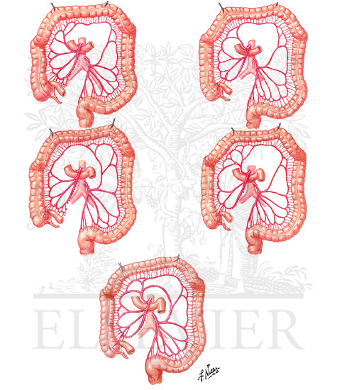 Variations in Colic Arteries